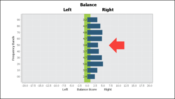 brain report card in the onset of stress