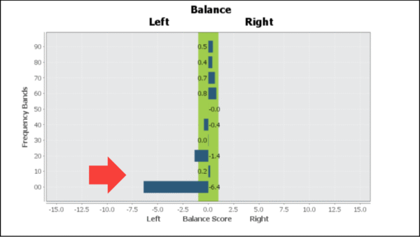 brain report card in burnout
