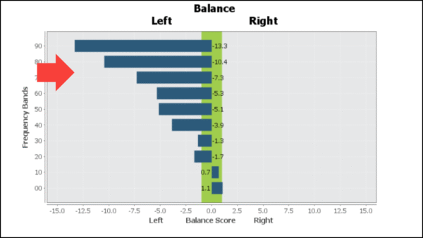 brain report graph of brain in burnout